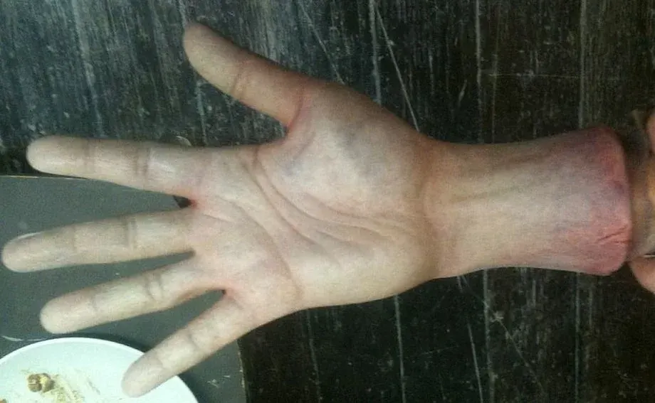 BK Hand, prosthetic makeup by Main Character Creations (photo 2)