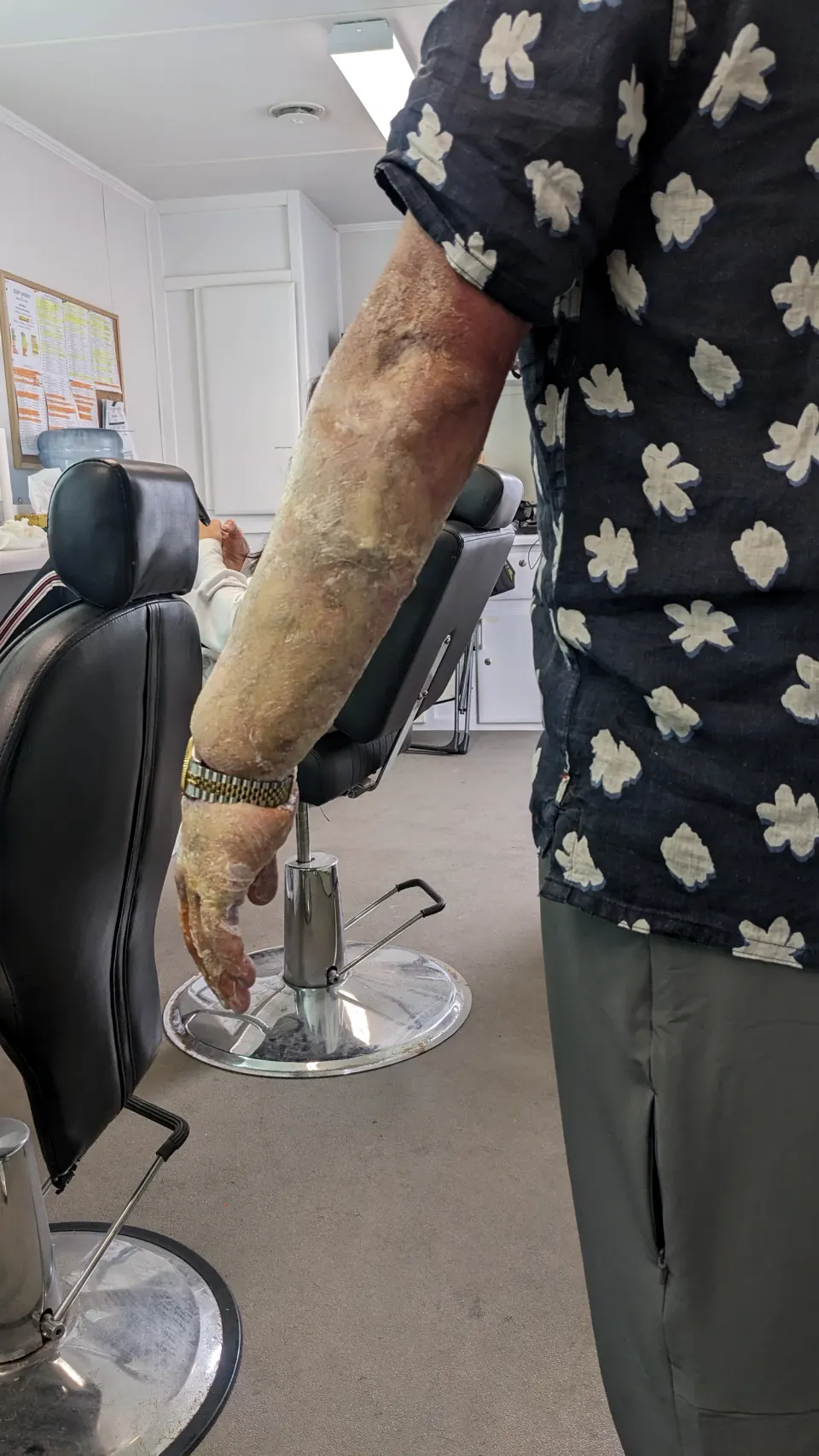 Bloated Arm, prosthetic makeup by Main Character Creations (photo 3)
