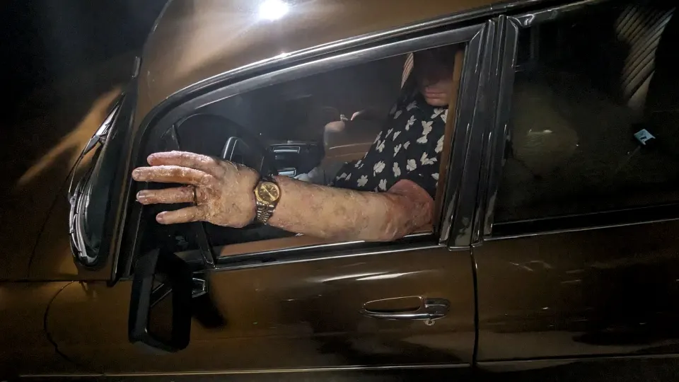 Bloated Arm, prosthetic makeup by Main Character Creations (photo 4)