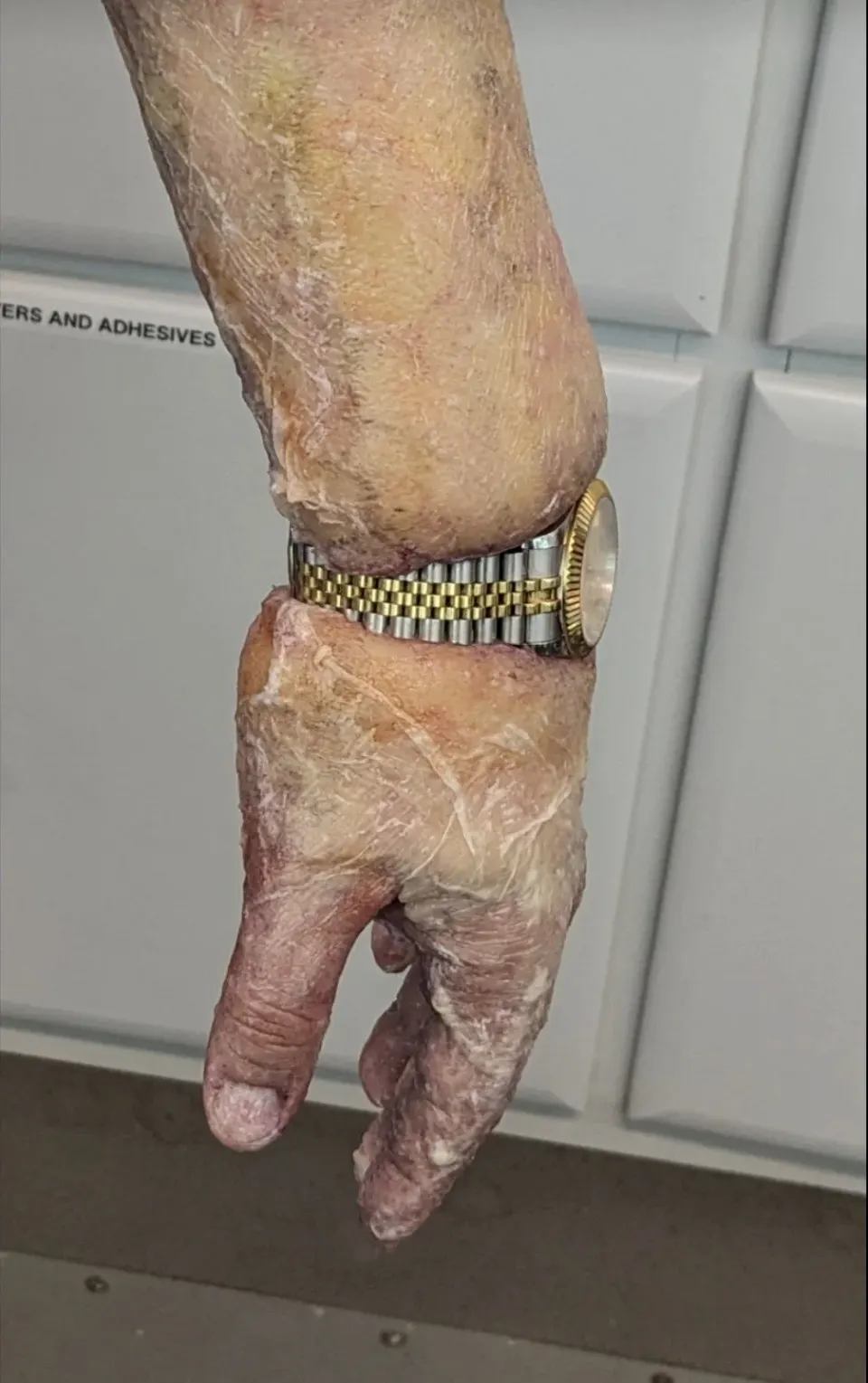 Bloated Arm, prosthetic makeup by Main Character Creations (photo 5)