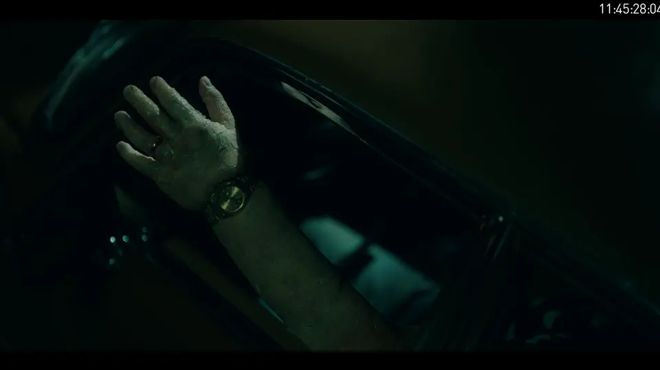 Bloated Arm, prosthetic makeup by Main Character Creations (photo 8)