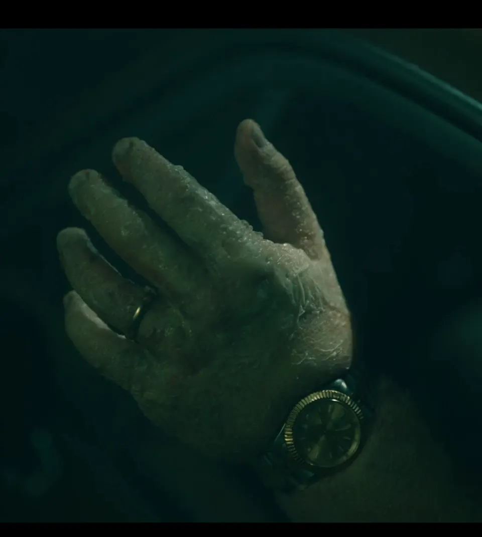 Bloated Arm, prosthetic makeup by Main Character Creations (photo 10)