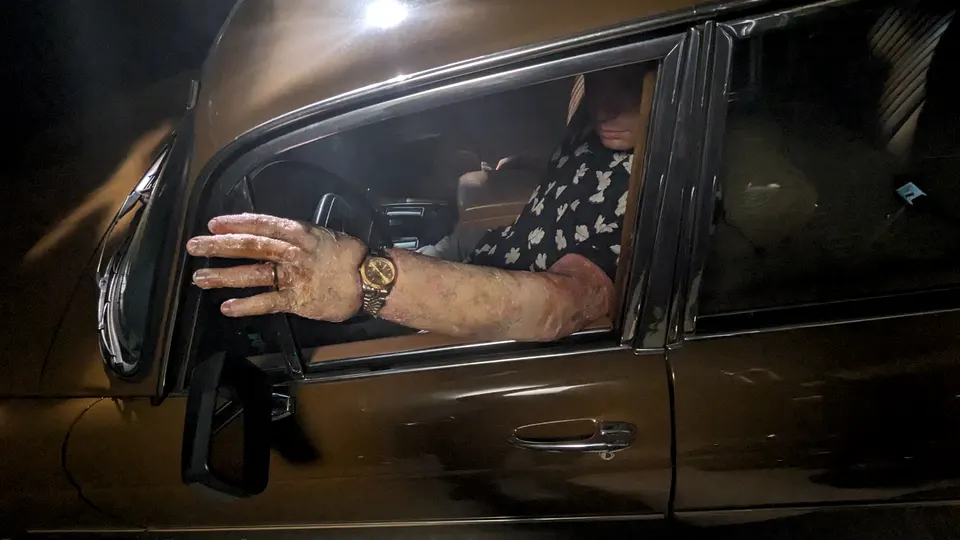 Bloated Arm, prosthetic makeup by Main Character Creations (photo 12)
