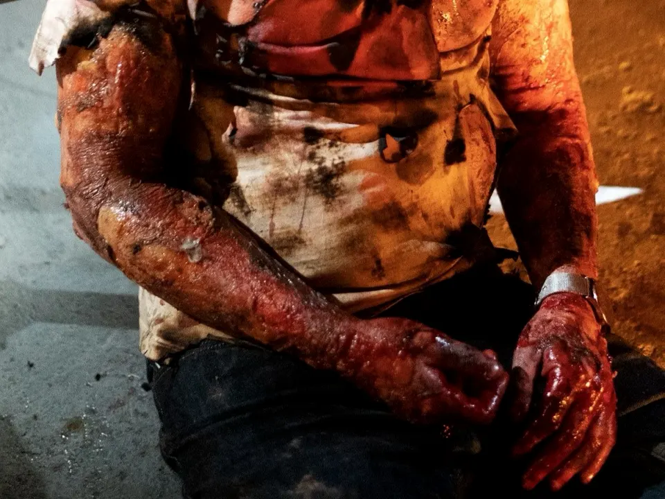 Jonathan Rhys Meyers: Burn, injury & gore effects by Main Character Creations (photo 2)