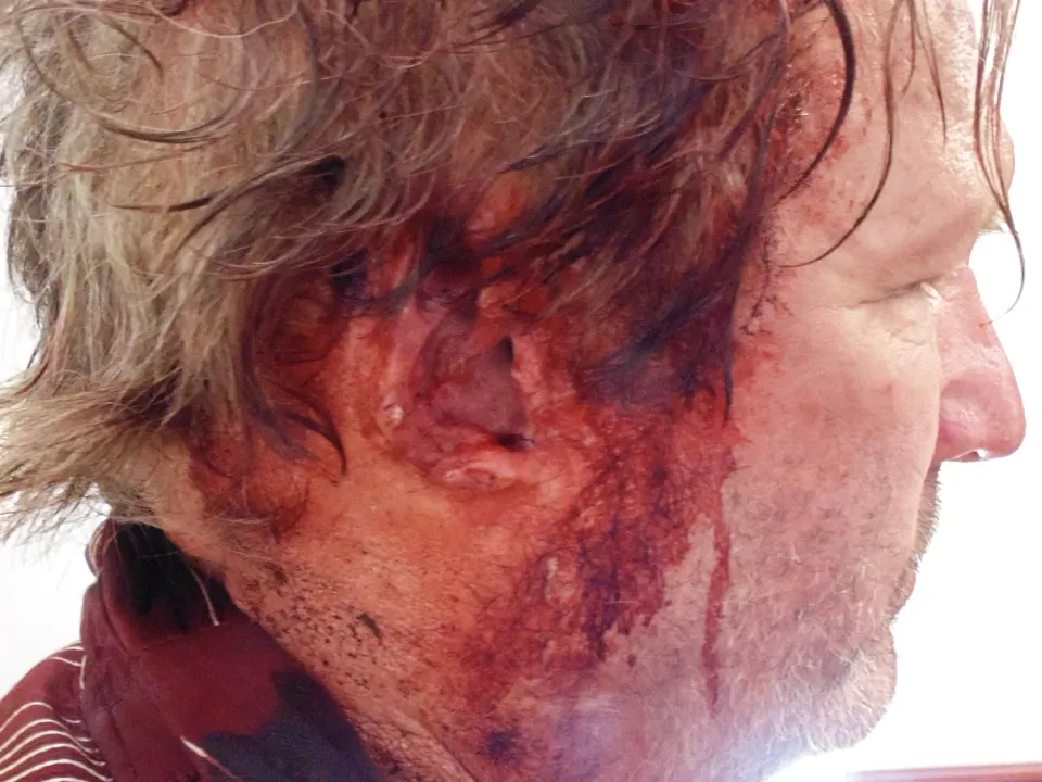 Martin Donovan, injury & gore effects by Main Character Creations (photo 4)