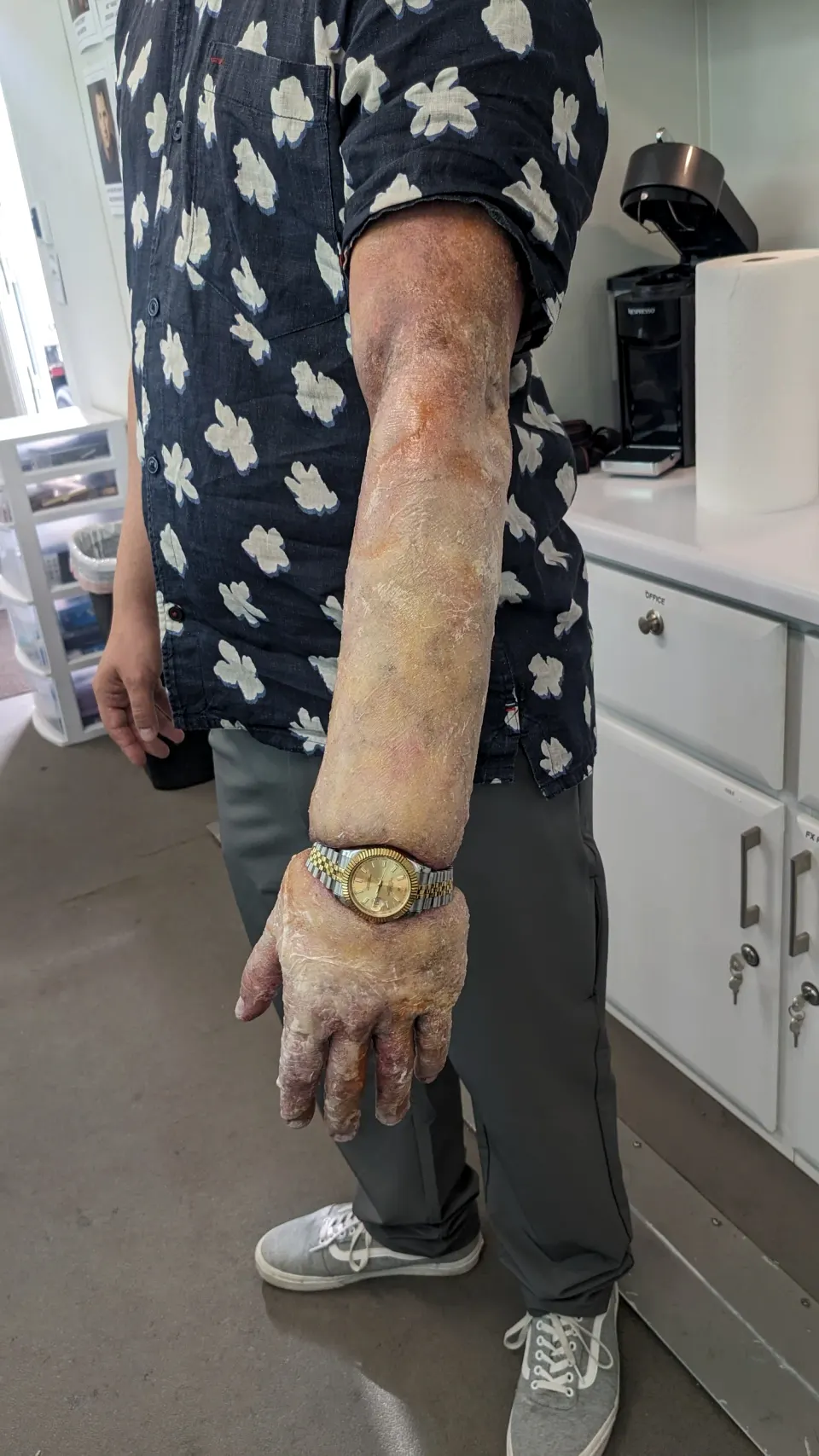 Prosthetics, prosthetic makeup by Main Character Creations (photo 4)
