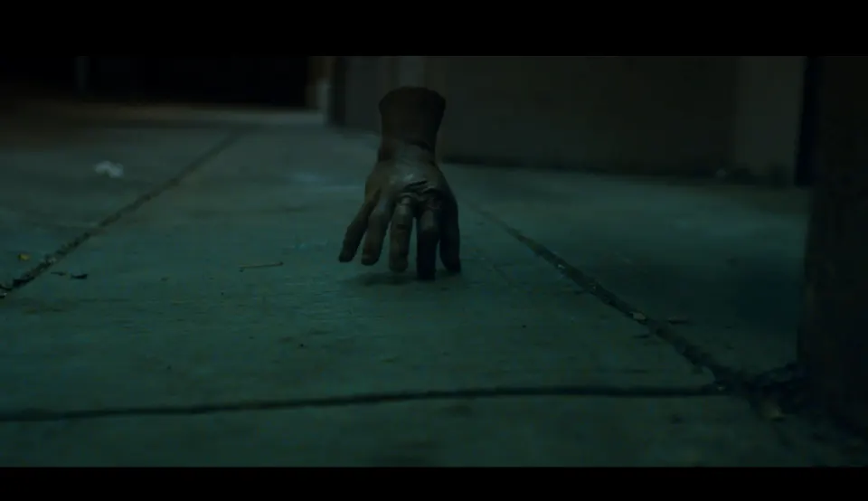 Severed Hand